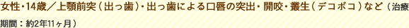 3.女性・14歳／上顎前突（出っ歯）・出っ歯による口唇の突出・開咬・叢生（デコボコ）など（治療期間：約2年11ヶ月）