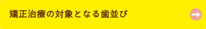 矯正治療の対象となる歯並び