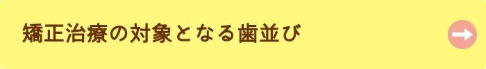 矯正治療の対象となる歯並び