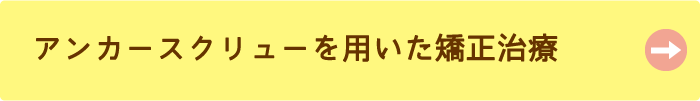 アンカースクリュー矯正